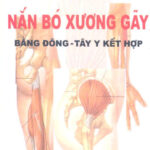 Nan bo xuong gay bang Dong Tay y ket hop
